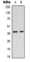 DNAM-1 / CD226 Antibody - Western blot analysis of CD226 expression in HEK293T (A); mouse brain (B) whole cell lysates.