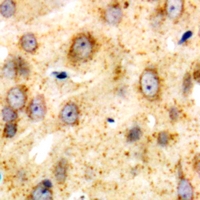 DNAM-1 / CD226 Antibody - Immunohistochemical analysis of CD226 staining in human brain formalin fixed paraffin embedded tissue section. The section was pre-treated using heat mediated antigen retrieval with sodium citrate buffer (pH 6.0). The section was then incubated with the antibody at room temperature and detected using an HRP polymer system. DAB was used as the chromogen. The section was then counterstained with hematoxylin and mounted with DPX.