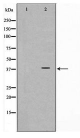 DNAM-1 / CD226 Antibody - Western blot of COS7 cell lysate using CD226/DNAM-1 Antibody