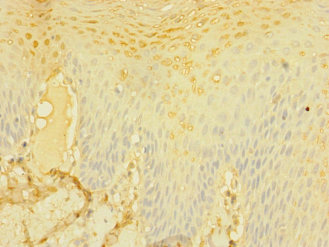 DNAM-1 / CD226 Antibody - Immunohistochemistry of paraffin-embedded human tonsil tissue at dilution 1:100