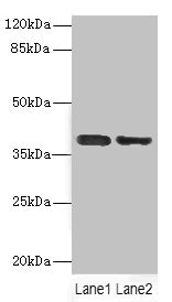 DNAM-1 / CD226 Antibody - Western blot All Lanes: CD226antibody at 2.61ug/ml Lane 1: Mouse brain tissue Lane 2: A549 whole cell lysate Secondary Goat polyclonal to rabbit IgG at 1/10000 dilution Predicted band size: 39 kDa Observed band size: 39 kDa
