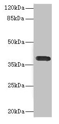 DNAM-1 / CD226 Antibody - Western blot All lanes: CD226 antibody at 2.61µg/ml + A549 whole cell lysate Secondary Goat polyclonal to rabbit IgG at 1/10000 dilution Predicted band size: 39 kDa Observed band size: 39 kDa