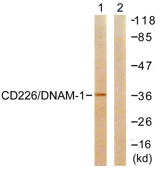 DNAM-1 / CD226 Antibody - Western blot analysis of extracts from 293 cells, treated with PMA (125ng/ml, 30mins), using CD226/DNAM-1 (Ab-329) antibody.