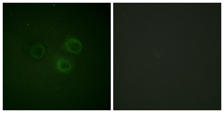 DNAM-1 / CD226 Antibody - Immunofluorescence analysis of A549 cells, using CD226/DNAM-1 (Phospho-Ser329) Antibody. The picture on the right is blocked with the phospho peptide.