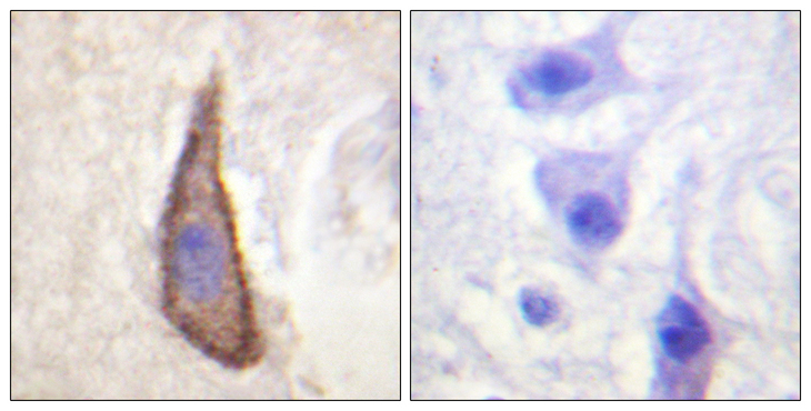 DNAM-1 / CD226 Antibody - Immunohistochemistry analysis of paraffin-embedded human brain, using CD226/DNAM-1 (Phospho-Ser329) Antibody. The picture on the right is blocked with the phospho peptide.