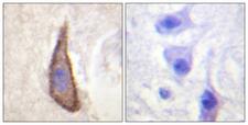 DNAM-1 / CD226 Antibody - P-peptide - + Immunohistochemistry analysis of paraffin-embedded human brain tissue using CD226/DNAM-1 (Phospho-Ser329) antibody.