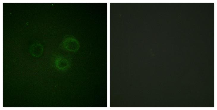 DNAM-1 / CD226 Antibody - P-peptide - + Immunofluorescence analysis of A549 cells, using CD226/DNAM-1 (Phospho-Ser329) antibody.