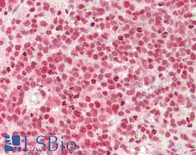 DNASE1 / DNase I Antibody - Human Spleen: Formalin-Fixed, Paraffin-Embedded (FFPE)