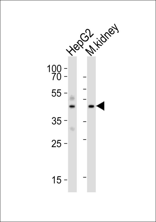 DNASE1 / DNase I Antibody - Western blot of lysates from HepG2 cell line, mouse kidney tissue lysate (from left to right), using DNASE1 antibody diluted at 1:1000 at each lane. A goat anti-rabbit IgG H&L (HRP) at 1:10000 dilution was used as the secondary antibody. Lysates at 20 ug per lane.