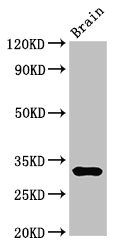 DNASE1 / DNase I Antibody - Western Blot Positive WB detected in:Mouse brain tissue All Lanes:DNASE1 antibody at 3µg/ml Secondary Goat polyclonal to rabbit IgG at 1/50000 dilution Predicted band size: 32,20 KDa Observed band size: 32 KDa