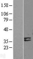 DNASE1L1 Protein - Western validation with an anti-DDK antibody * L: Control HEK293 lysate R: Over-expression lysate