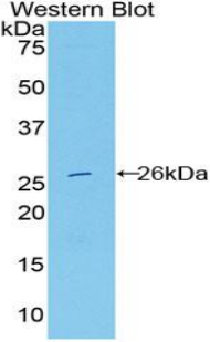 DNASE1L2 Antibody - Western blot of recombinant DNASE1L2.  This image was taken for the unconjugated form of this product. Other forms have not been tested.