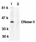 DNASE2 / DNase II Antibody - Western blot of human spleen lysate probed with Rabbit anti-Human DNASE-II either in the absence (1) or presence (2) of blocking peptide