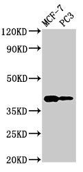 DNASE2 / DNase II Antibody - Western Blot Positive WB detected in: MCF-7 whole cell lysate, PC-3 whole cell lysate All lanes: DNASE2 antibody at 2.7µg/ml Secondary Goat polyclonal to rabbit IgG at 1/50000 dilution Predicted band size: 40, 34 kDa Observed band size: 40 kDa