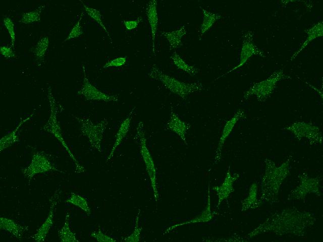 DNASE2 / DNase II Antibody - Immunofluorescence staining of DNASE2 in Hela cells. Cells were fixed with 4% PFA, permeabilzed with 0.1% Triton X-100 in PBS, blocked with 10% serum, and incubated with rabbit anti-Human DNASE2 polyclonal antibody (dilution ratio 1:500) at 4°C overnight. Then cells were stained with the Alexa Fluor 488-conjugated Goat Anti-rabbit IgG secondary antibody (green). Positive staining was localized to Cytoplasm.