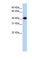 DNASE2B Antibody - DNASE2B antibody Western blot of Fetal Muscle lysate. This image was taken for the unconjugated form of this product. Other forms have not been tested.