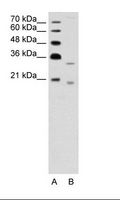 DNASE2B Antibody - A: Marker, B: Jurkat Cell Lysate.  This image was taken for the unconjugated form of this product. Other forms have not been tested.