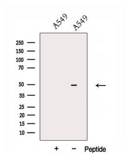 DNASE2B Antibody - Western blot analysis of extracts of A549 cells using DNASE2B antibody. The lane on the left was treated with blocking peptide.