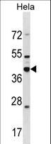 DND1 Antibody - DND1 Antibody western blot of HeLa cell line lysates (35 ug/lane). The DND1 antibody detected the DND1 protein (arrow).