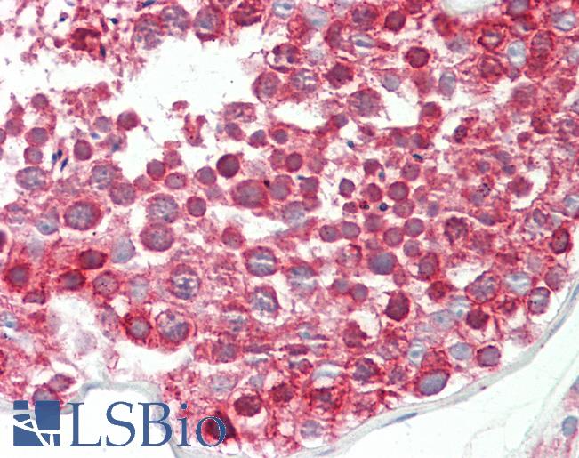 DND1 Antibody - Anti-DND1 antibody IHC staining of human testis. Immunohistochemistry of formalin-fixed, paraffin-embedded tissue after heat-induced antigen retrieval. Antibody concentration 5 ug/ml.  This image was taken for the unconjugated form of this product. Other forms have not been tested.