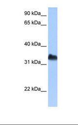 DND1 Antibody - Jurkat cell lysate. Antibody concentration: 0.5 ug/ml. Gel concentration: 12%.  This image was taken for the unconjugated form of this product. Other forms have not been tested.