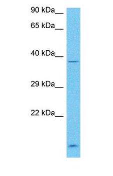 DND1 Antibody - Western blot of DND1 Antibody with human RPMI-8226 Whole Cell lysate.  This image was taken for the unconjugated form of this product. Other forms have not been tested.