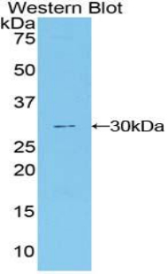 DNER / BET Antibody - Western blot of recombinant DNER / BET.  This image was taken for the unconjugated form of this product. Other forms have not been tested.