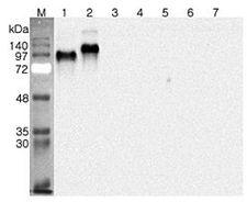 DNER / BET Antibody - Western blot analysis using anti-DNER (human), pAb at 1:4000 dilution. 1: Human DNER (ED) (FLAG-tagged). 2: Human DNER (ED) Fc-protein. 3: Human DLL1 (His-tagged). 4: Human DLL4 (His-tagged). 5: Human DLK1 (His-tagged). 6: Human Jagged-1 (His-tagged) (negative control). 7: Human FGF-23 Fc-protein (negative control).