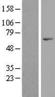 DNHD1 Protein - Western validation with an anti-DDK antibody * L: Control HEK293 lysate R: Over-expression lysate