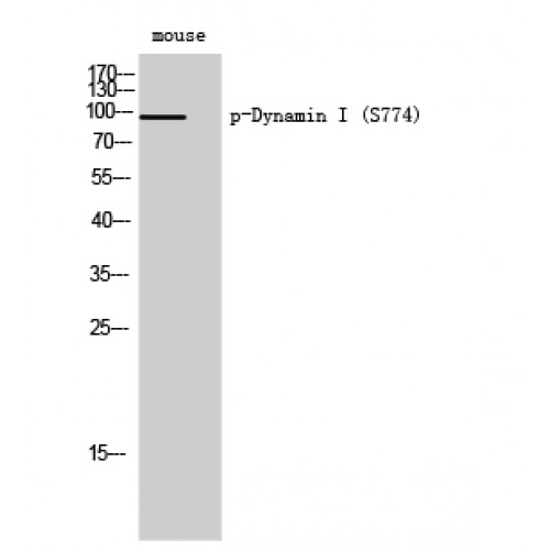 DNM1 / Dynamin Antibody - Western blot of Phospho-Dynamin I (S774) antibody