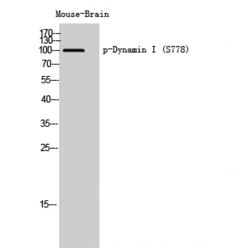 DNM1 / Dynamin Antibody - Western blot of Phospho-Dynamin I (S778) antibody
