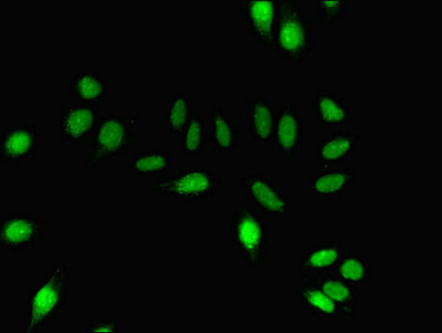 DNM1 / Dynamin Antibody - Immunofluorescent analysis of A549 cells using DNM1 Antibody at dilution of 1:100 and Alexa Fluor 488-congugated AffiniPure Goat Anti-Rabbit IgG(H+L)