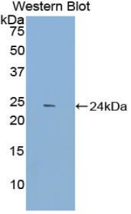 DNM1 / Dynamin Antibody - Western blot of recombinant DNM1 / Dynamin.