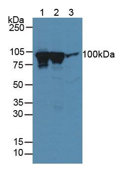 DNM1 / Dynamin Antibody - Western Blot; Sample: Lane1: Mouse Brain Tissue; Lane2: Rat Brain Tissue; Lane3: Human U-87 MG Cells.