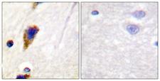 DNM1 / Dynamin Antibody - Immunohistochemistry analysis of paraffin-embedded human brain tissue, using Dynamin-1 Antibody. The picture on the right is blocked with the synthesized peptide.