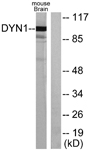 DNM1 / Dynamin Antibody - Western blot analysis of lysates from mouse brain, using Dynamin-1 Antibody. The lane on the right is blocked with the synthesized peptide.