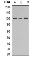 DNM1 / Dynamin Antibody - Western blot analysis of Dynamin 1 expression in NIH3T3 (A); mouse brain (B); PC12 (C) whole cell lysates.