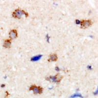 DNM1 / Dynamin Antibody - Immunohistochemical analysis of Dynamin 1 staining in human brain formalin fixed paraffin embedded tissue section. The section was pre-treated using heat mediated antigen retrieval with sodium citrate buffer (pH 6.0). The section was then incubated with the antibody at room temperature and detected using an HRP polymer system. DAB was used as the chromogen. The section was then counterstained with hematoxylin and mounted with DPX.