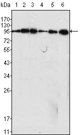 DNM1 / Dynamin Antibody - Dynamin 1 Antibody in Western Blot (WB)
