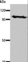 DNM1 / Dynamin Antibody - Western blot analysis of Mouse brain tissue, using DNM1 Polyclonal Antibody at dilution of 1:700.