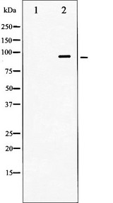DNM1 / Dynamin Antibody - Western blot analysis of Dynamin-1 expression in mouse brain tissue lysates. The lane on the left is treated with the antigen-specific peptide.