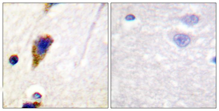DNM1 / Dynamin Antibody - Peptide - + Immunohistochemical analysis of paraffin-embedded human brain tissue using Dynamin-1 (Ab-774) Antibody.