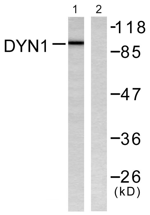 DNM1 / Dynamin Antibody - Western blot analysis of extracts from mouse brain, using Dynamin-1 (Ab-774) Antibody.