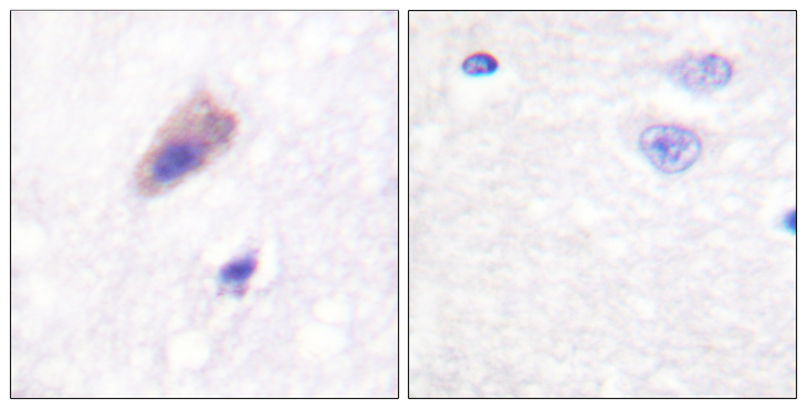 DNM1 / Dynamin Antibody - Immunohistochemistry analysis of paraffin-embedded human brain, using Dynamin-1 (Phospho-Ser774) Antibody. The picture on the right is blocked with the phospho peptide.