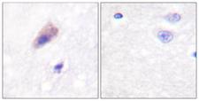 DNM1 / Dynamin Antibody - Immunohistochemistry analysis of paraffin-embedded human brain, using Dynamin-1 (Phospho-Ser774) Antibody. The picture on the right is blocked with the phospho peptide.