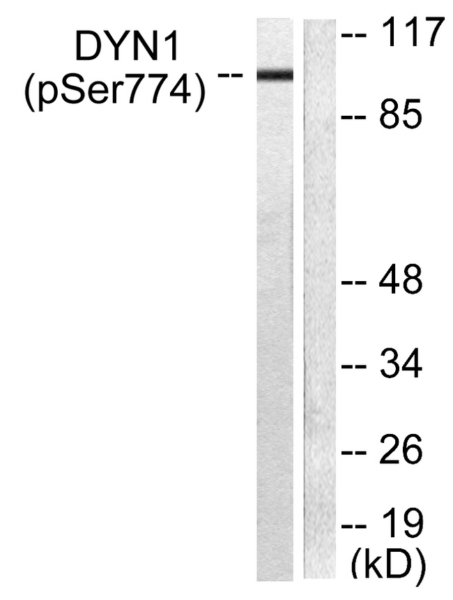 DNM1 / Dynamin Antibody - Western blot analysis of lysates from mouse brain, using Dynamin-1 (Phospho-Ser774) Antibody. The lane on the right is blocked with the phospho peptide.