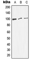 DNM1 / Dynamin Antibody - Western blot analysis of Dynamin 1 (pS774) expression in HeLa (A); NIH3T3 (B); PC12 (C) whole cell lysates.