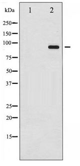 DNM1 / Dynamin Antibody - Western blot of Dynamin-1 phosphorylation expression in Mouse brain tissue lysates,The lane on the left is treated with the antigen-specific peptide.