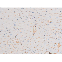 DNM1 / Dynamin Antibody - 1:200 staining mouse heart tissue by IHC-P. The tissue was formaldehyde fixed and a heat mediated antigen retrieval step in citrate buffer was performed. The tissue was then blocked and incubated with the antibody for 1.5 hours at 22°C. An HRP conjugated goat anti-rabbit antibody was used as the secondary.