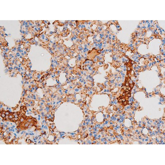 DNM1 / Dynamin Antibody - 1:200 staining mouse lung tissue by IHC-P. The tissue was formaldehyde fixed and a heat mediated antigen retrieval step in citrate buffer was performed. The tissue was then blocked and incubated with the antibody for 1.5 hours at 22°C. An HRP conjugated goat anti-rabbit antibody was used as the secondary.